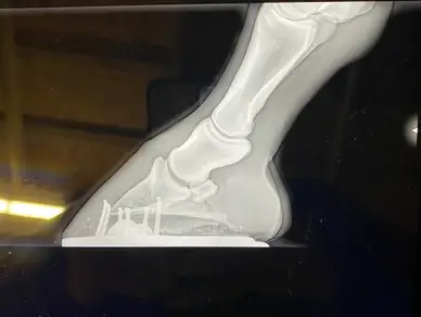 A picture of an x-ray image of the foot.